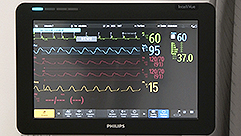 20250612_Monitorizacion_Philips